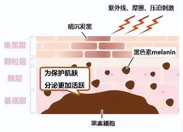 关节黑怎么变白，关节黑怎么变白买什么（手肘、私处发黑的有效改善方法）