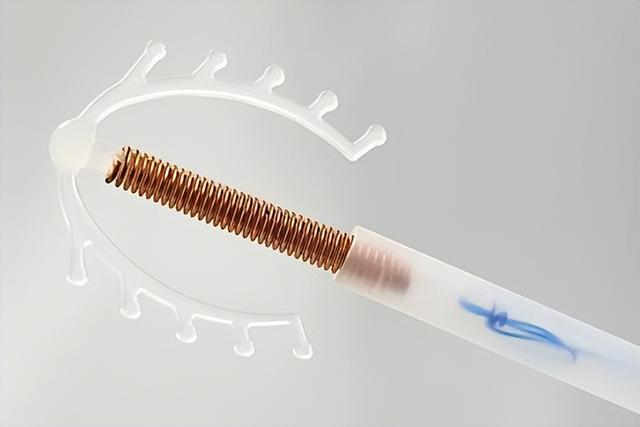 人流手术前要准备什么，人流手术前要准备什么东西（节育环一直不取出来）