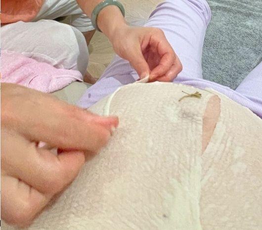 滚针做一次就会有效果吗，滚针做一次就会有效果吗知乎（医生：真正靠谱只有这几点）