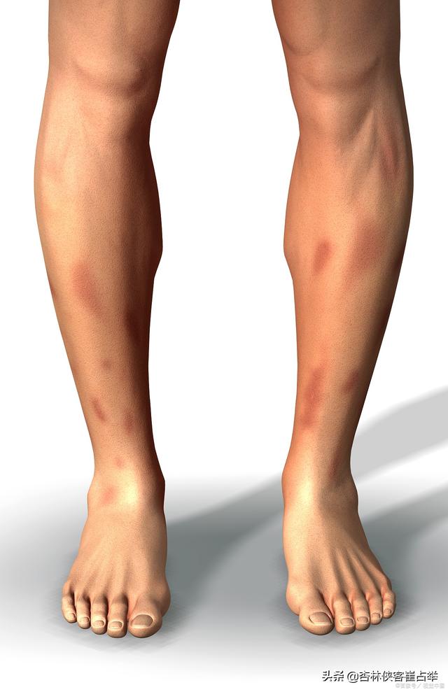 白矾的功效与作用，白矾外敷的功效与作用（结节、囊肿、增生）