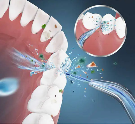 牙线哪个品牌好用，牙线怎么正确使用（十大冲牙器/水牙线品牌排行榜）
