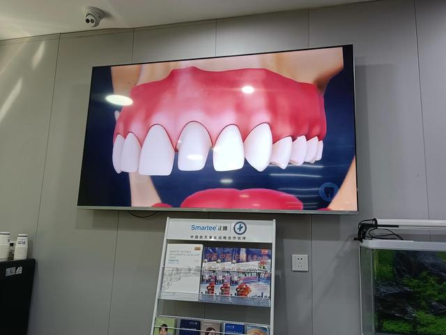 一般补牙需要多少钱，补牙需要多少钱门牙裂了（4000补一颗牙齿你觉得贵吗）