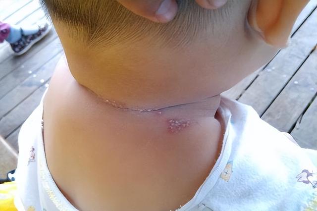 宝宝嘴巴吐唾沫，刚出生宝宝嘴巴吐唾沫（宝宝爱吐舌头和大脑发育有关）