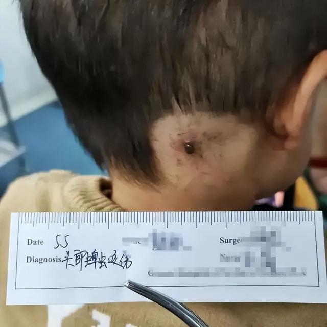 蜱虫是什么，可致命：夏季出游当心此虫（蜱虫是什么样的毒虫）