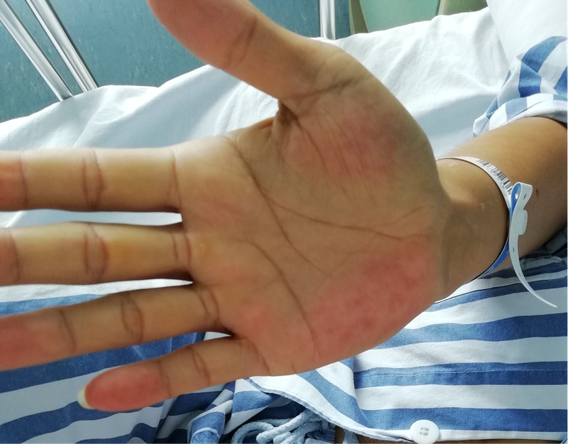 左右手长痣是什么意思男,左右手背长痣是什么意思女 - 珍缘易学
