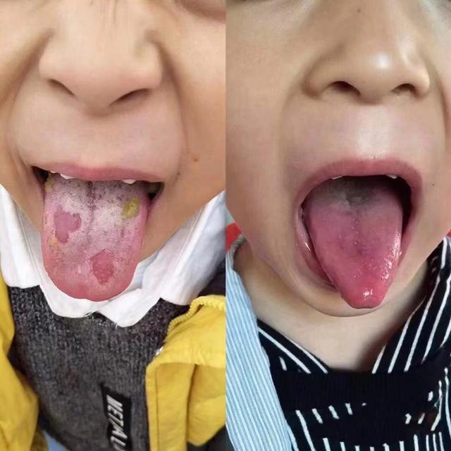 新生儿身高体重对照表2022，婴儿身高体重标准表（2022新学期身高标准表）