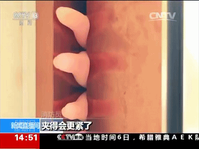 手被门夹了怎么处理，被门夹住手指应该怎么办（孩子手指被门夹）