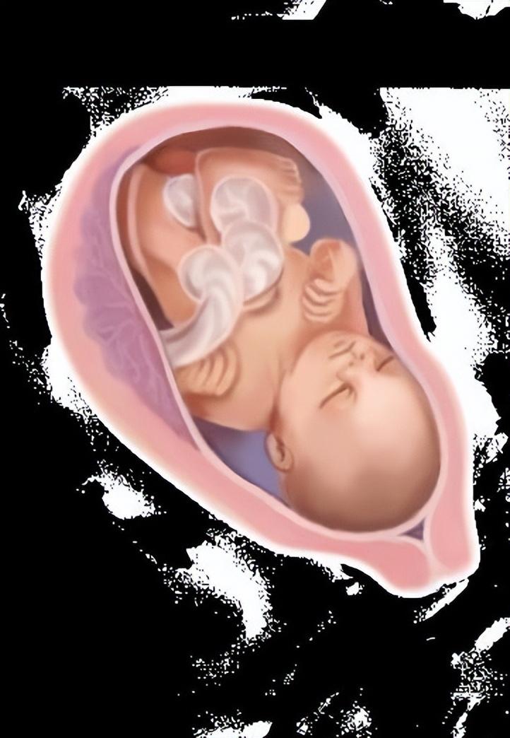 怀孕13周胎儿图片欣赏(从受精卵到新生儿) 