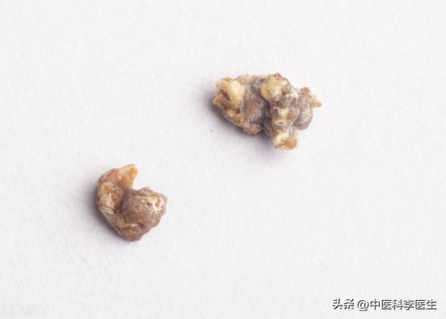 金钱草的禁忌和相克，金钱草副作用与禁忌症（6味中药兵分三路）