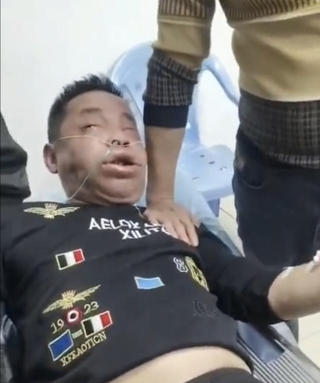 竹叶青的毒性多强，比五步蛇还强20倍