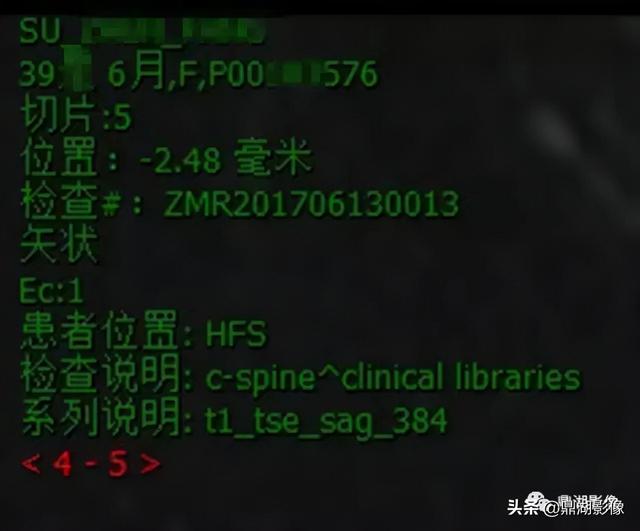 r和l哪个是左哪个是右，袜子r和l哪个是左哪个是右（竟然包含了这么多的信息）