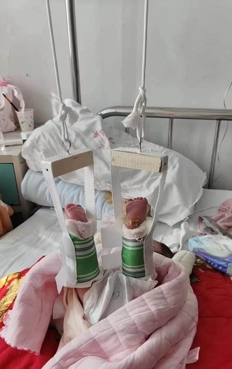 病历证明图片（剖腹产新生儿异常哭闹两天查出大腿骨折）