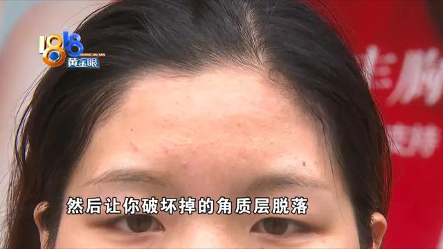 果酸换肤祛痘效果怎么样，果酸换肤祛痘效果怎么样的（“果酸焕肤”又红又肿）