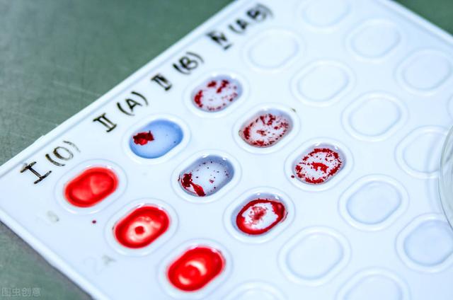 a型血人的性格特点，a型血女人的性格特点（科学家找出血型与肠道健康的关系）