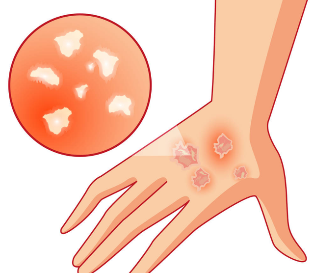 猴痘病毒是什么，十大最厉害的病毒（关于这个“隐秘的病毒”）