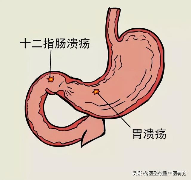 多,血糖無異常,患者面色發黃,精神不好,食慾不佳,口唇舌淡,舌苔薄白