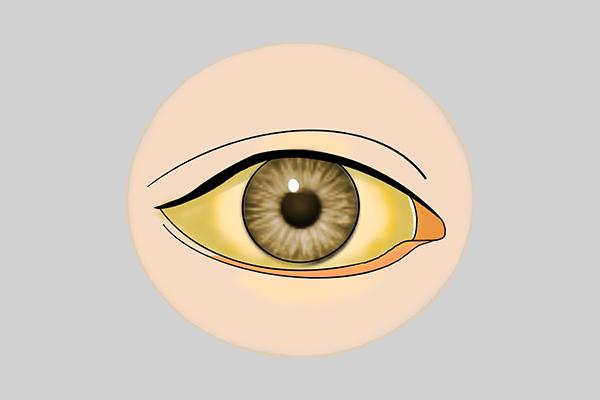 视力证明（不起眼的坏习惯）