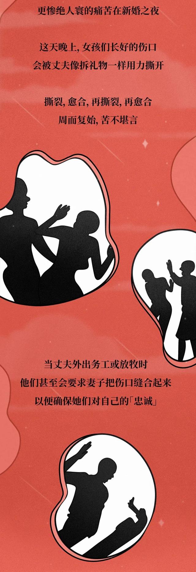 割礼女性是割哪里，女性割礼是割什么地方（到底让多少女性失去了“性与爱”的权利）