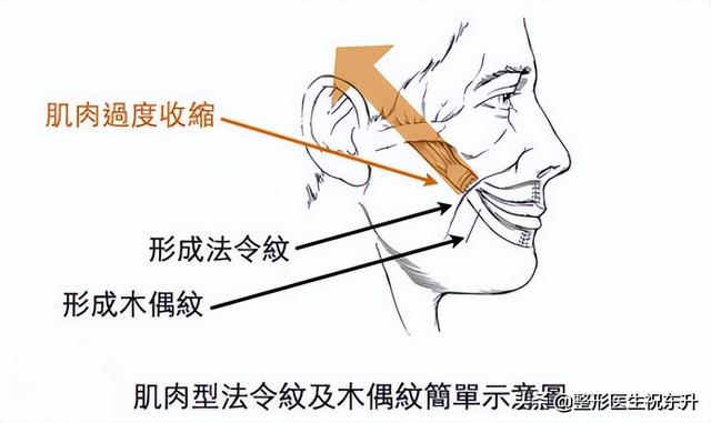 怎样淡化法令纹，怎么淡化法令纹（这“3个方法”实用又有效）
