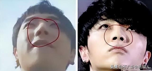 整容后遗症有哪些，整容后遗症有哪一些（明星整容后遗症明显）