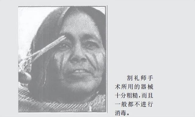 什么叫割礼，什么叫割礼手术（1.3亿人遭受的割礼之痛）