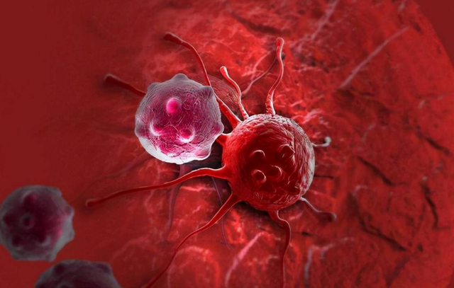 心脏癌最严重的肿瘤，得上心血管肉瘤，比癌症还可怕