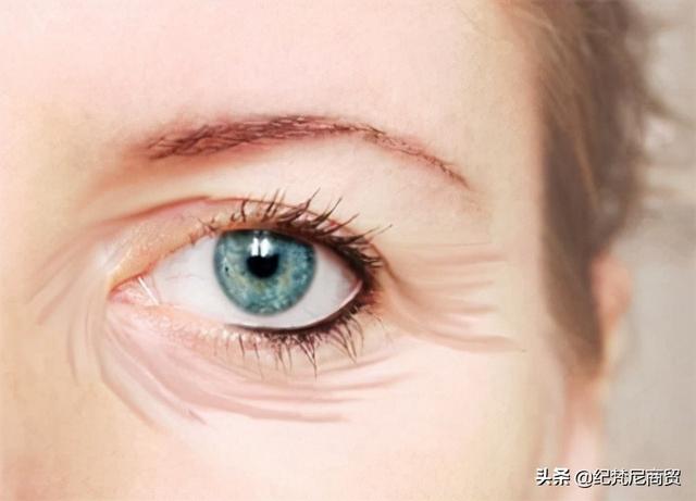 眼部皱纹形成的原因，眼部皱纹怎么形成的原因（为什么眼睛周围容易产生皱纹）