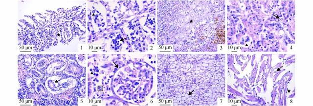 dpbs和pbs的区别，pbs缓冲液配制（四川地区养殖鲫鲤疱疹病毒Ⅱ型的鉴定及病理学研究）