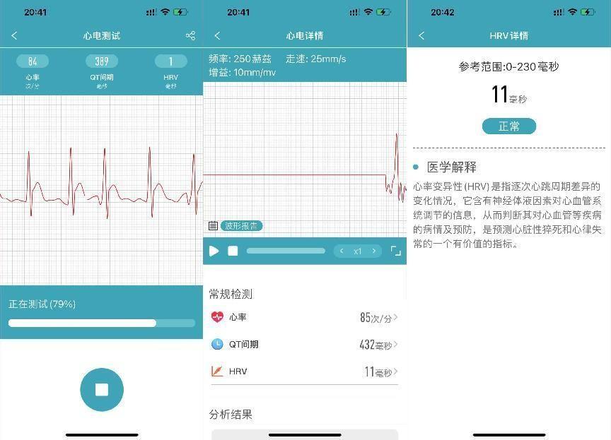 dido手环使用教程，dido手环佩戴方法