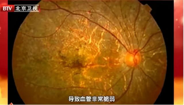 皇帝油有什么功效，皇帝油如何使用（又是平价“皇帝菜”）