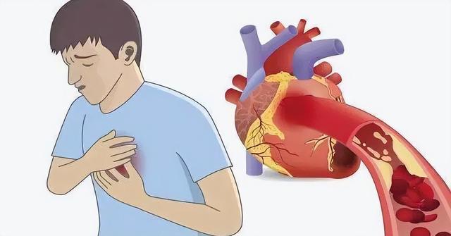 电极片有什么用，硅胶电极贴片说明书（救命神器AED常见使用十问十答精华汇总）