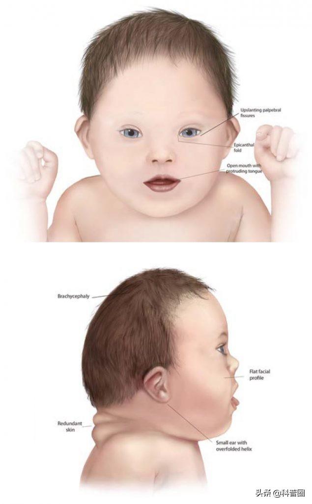 蒙古褶，为何被称“黄种人”（蒙古褶皱）