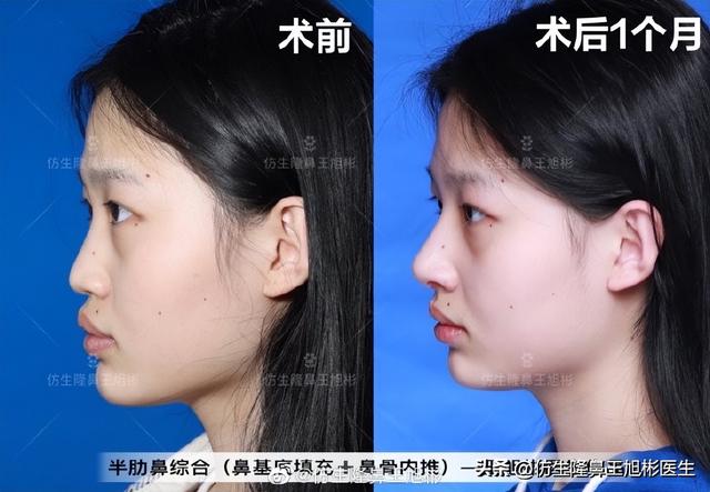 高级脸是什么意思，6种脸型不显老（“月亮脸”逆袭“高级脸”的不二法则是）