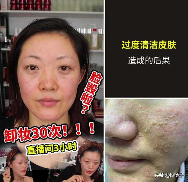 没有卸妆水可以用什么代替，没有卸妆水用什么代替（有没有什么一瓶就可以代替多瓶的只擦一种就可以的护肤品）