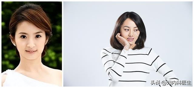 脸黑是什么病，脸黑是什么病症（如何通过脸色表情判断身体的毛病）