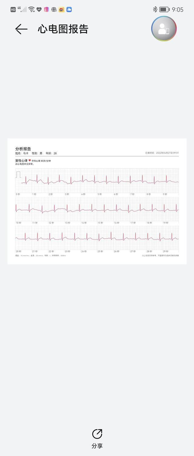 如何打印百度地图的路线详细信息，打印百度地图教程（评测：全网最懂你健康的表）