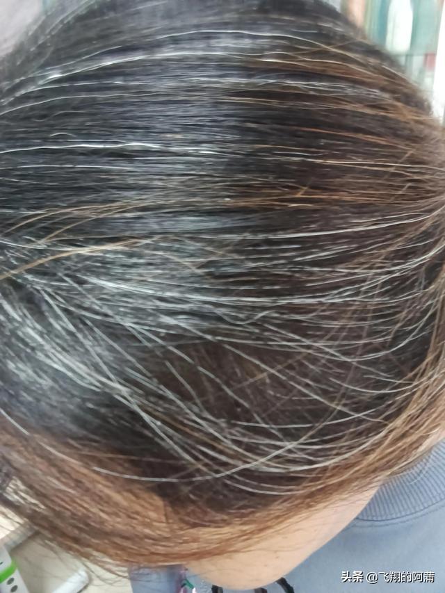 侧柏叶洗头发的正确方法，侧柏叶洗头真实经历（试试能不能白发转黑发）