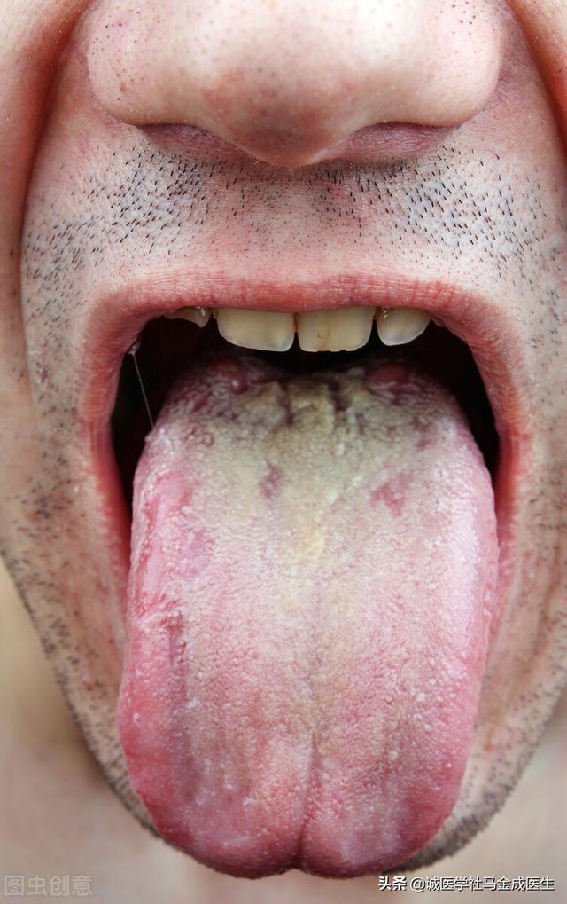 风寒感冒中成药，风寒感冒吃什么药好（风寒、风热、流行性、虚体、暑湿感冒）