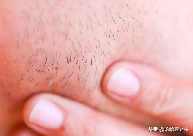电动剃须刀怎么用，电动剃须刀怎么用不会刮伤（如何使用电动剃须刀剃须）