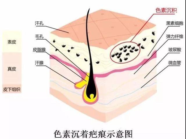 祛疤痕的最好方法小窍门，孩子受伤后留下疤痕