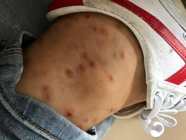 猷蠓怎么保存，猷蠓可以放多久（连无蚊无蛇的冰岛都有分布）