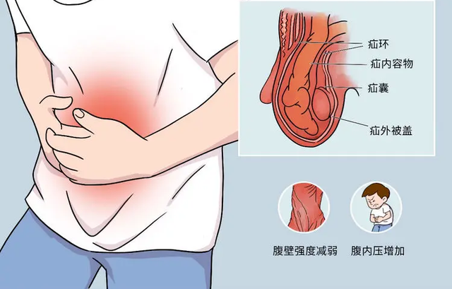 肚子大像怀孕一样是什么原因,小腹突然变大像怀孕了一样(肚子为啥大的