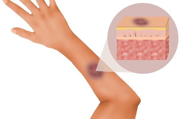 尿液透明像自来水，尿液透明像自来水是肾虚吗（或是肝有问题）