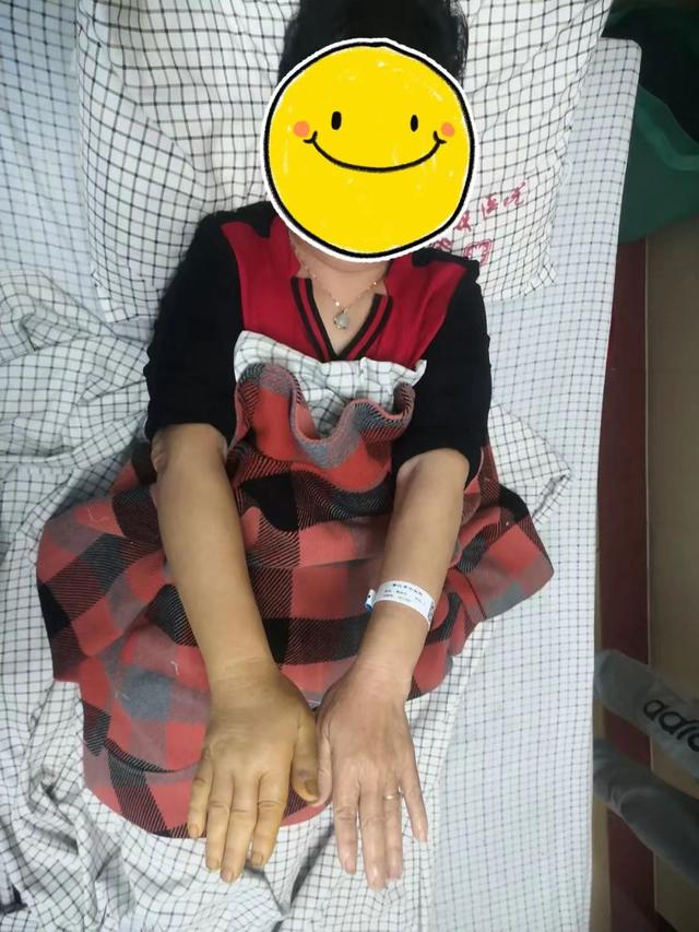 白唇竹叶青，有多毒？比五步蛇还强20倍（白唇竹叶青图片）