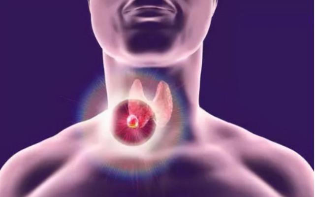 乌鸡汤是发物吗，发物最厉害的十种食物（这些“发物”建议少碰）