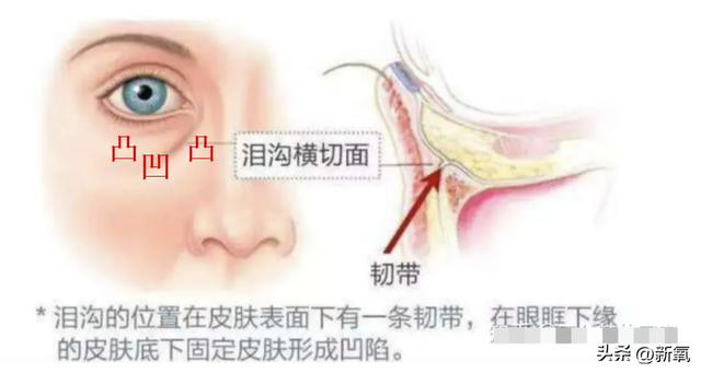 黑眼圈用什么颜色遮瑕，黑眼圈用啥遮瑕（黑眼圈+乌青泪沟+眼袋）