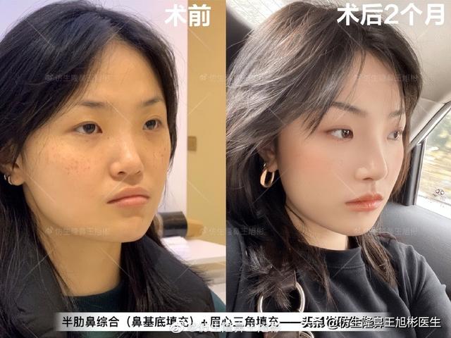 高级脸是什么意思，6种脸型不显老（“月亮脸”逆袭“高级脸”的不二法则是）