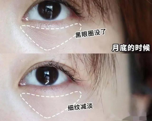 眼霜真的有必要使用吗，看到杨幂对护肤品“取舍”后