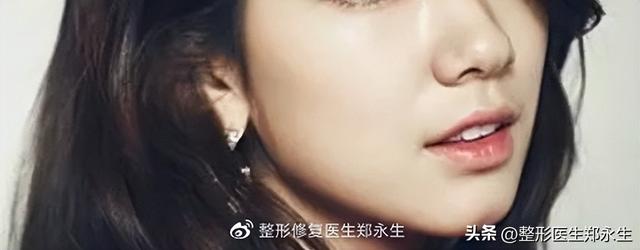 鼻头缩小术千万别做，鼻缩小手术千万别做（肉鼻子做了鼻头缩小结果越“缩”越“大”）