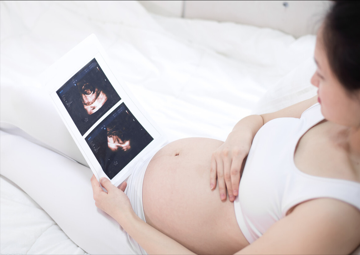 医院开的怀孕证明图片（B超下的孕象百态）